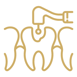 Root Canal Therapy